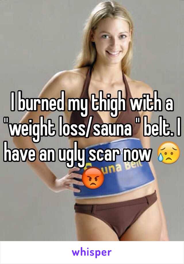 I burned my thigh with a "weight loss/sauna " belt. I have an ugly scar now 😥😡