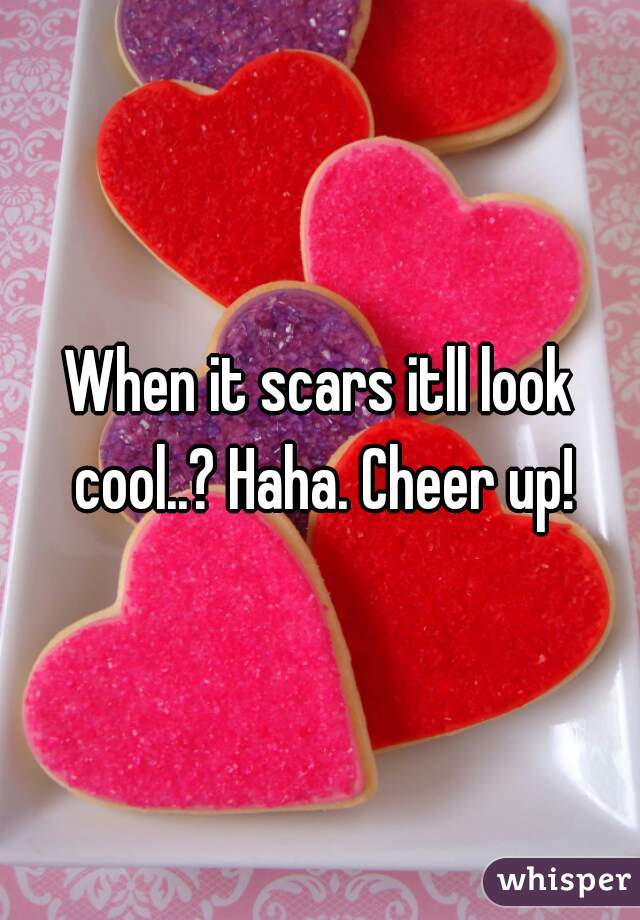 When it scars itll look cool..? Haha. Cheer up!