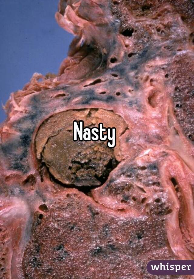 Nasty 