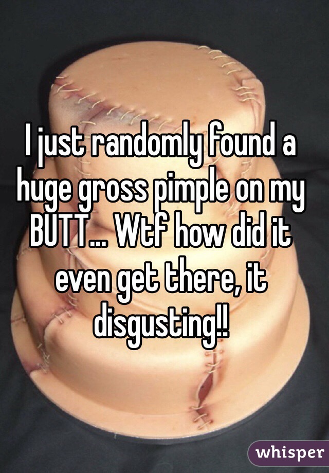 I just randomly found a huge gross pimple on my BUTT... Wtf how did it even get there, it disgusting!!