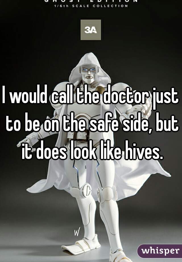 I would call the doctor just to be on the safe side, but it does look like hives.
