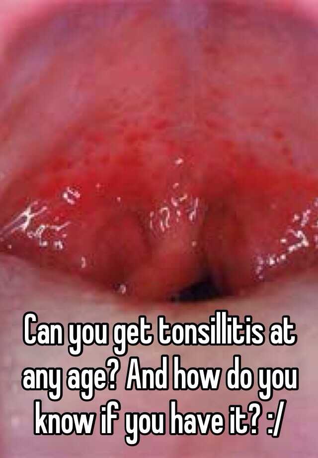 can-you-get-tonsillitis-at-any-age-and-how-do-you-know-if-you-have-it