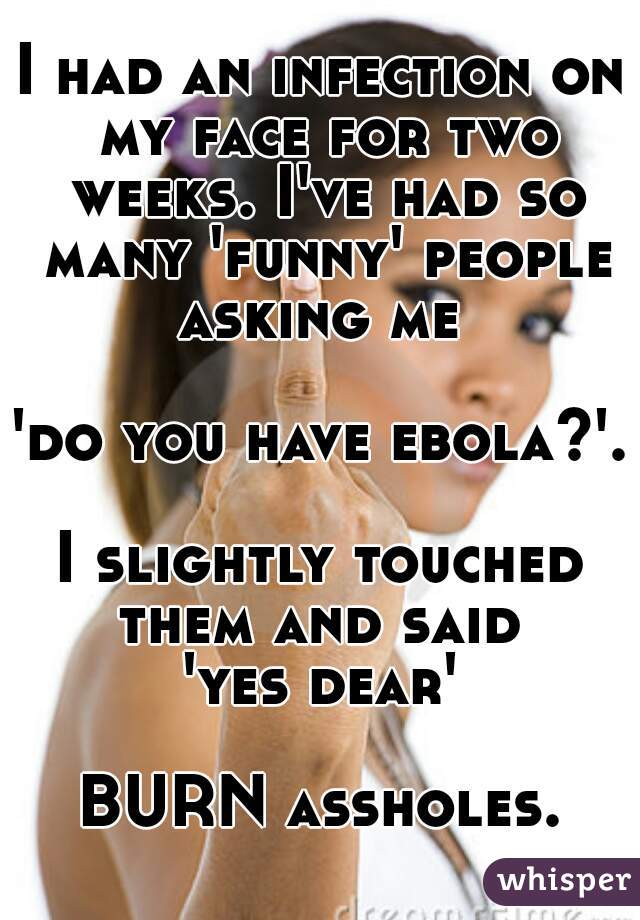 I had an infection on my face for two weeks. I've had so many 'funny' people asking me 

'do you have ebola?'.

I slightly touched them and said 
'yes dear'

BURN assholes.