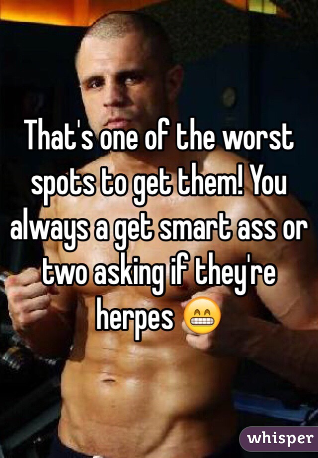 That's one of the worst spots to get them! You always a get smart ass or two asking if they're herpes 😁