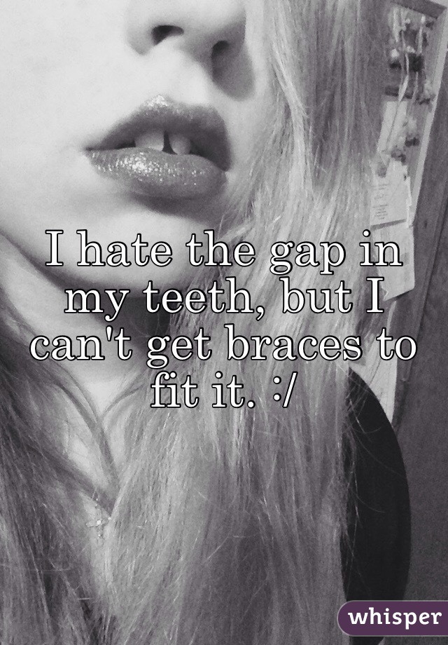 I hate the gap in my teeth, but I can't get braces to fit it. :/