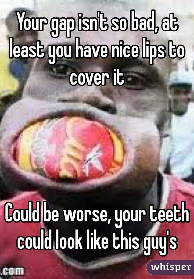 Your gap isn't so bad, at least you have nice lips to cover it




Could be worse, your teeth could look like this guy's 