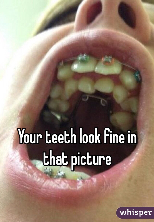 Your teeth look fine in that picture
