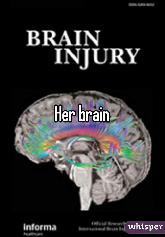 Her brain
