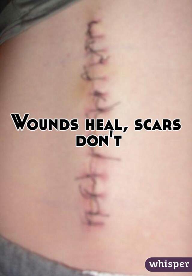 Wounds heal, scars don't