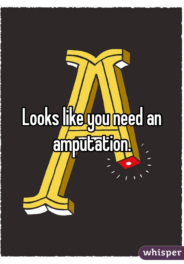 Looks like you need an amputation. 