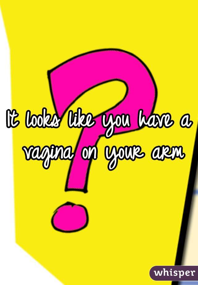 It looks like you have a vagina on your arm