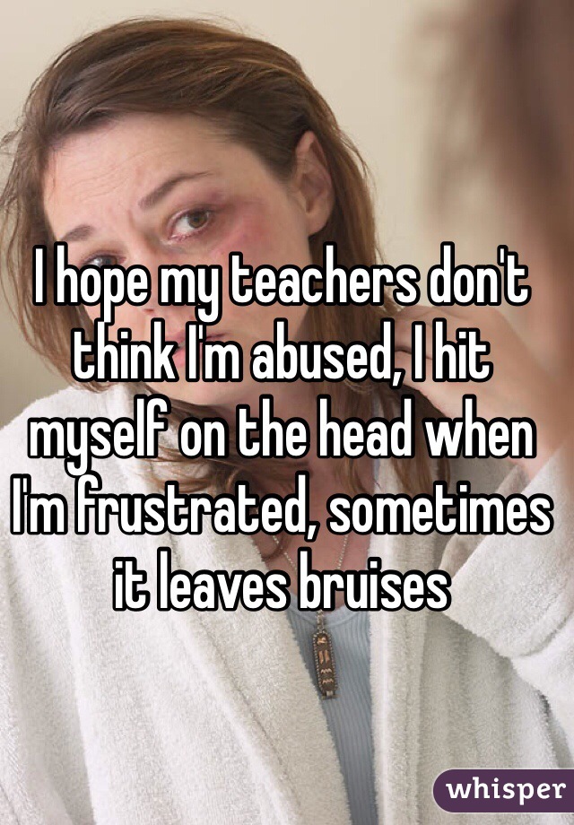 I hope my teachers don't think I'm abused, I hit myself on the head when I'm frustrated, sometimes it leaves bruises 
