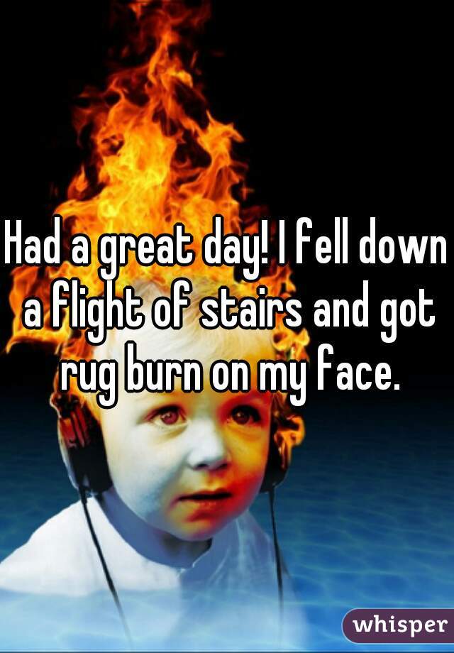 Had a great day! I fell down a flight of stairs and got rug burn on my face.