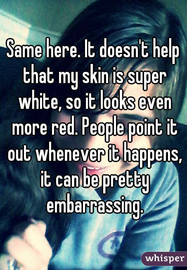 Same here. It doesn't help that my skin is super white, so it looks even more red. People point it out whenever it happens, it can be pretty embarrassing.