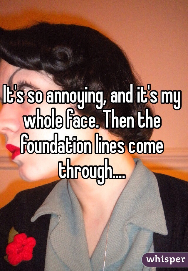 It's so annoying, and it's my whole face. Then the foundation lines come through....
