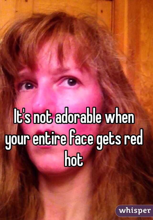 It's not adorable when your entire face gets red hot