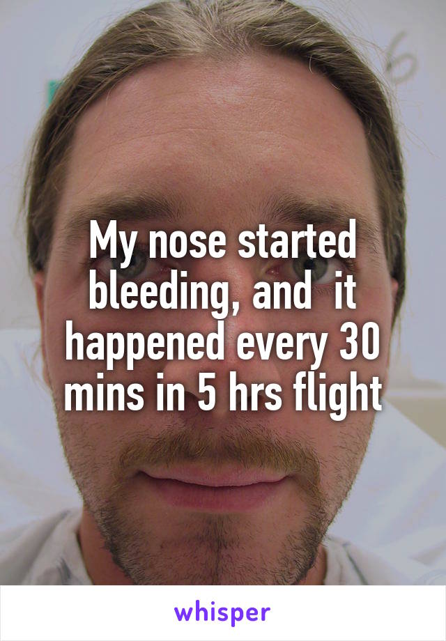 My nose started bleeding, and  it happened every 30 mins in 5 hrs flight