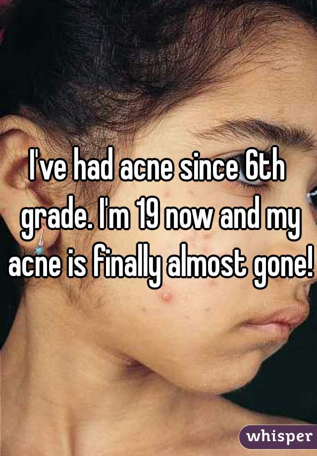 I've had acne since 6th grade. I'm 19 now and my acne is finally almost gone!