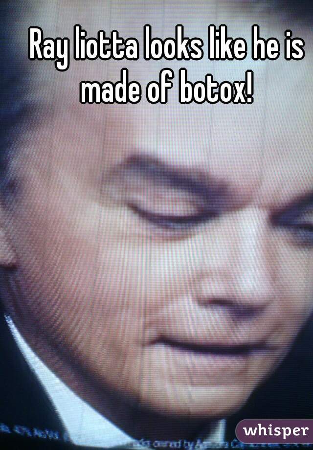 Ray liotta looks like he is made of botox! 