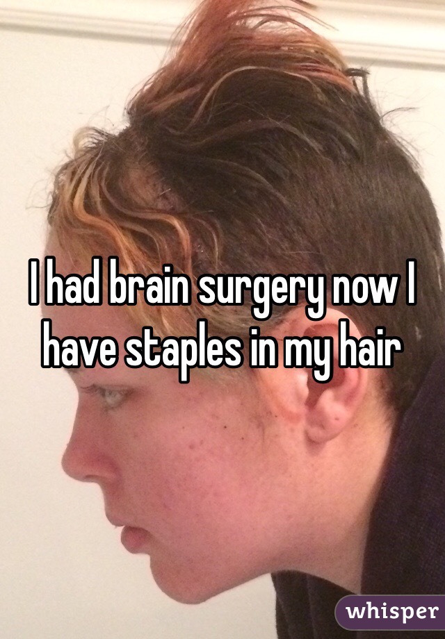 I had brain surgery now I have staples in my hair 