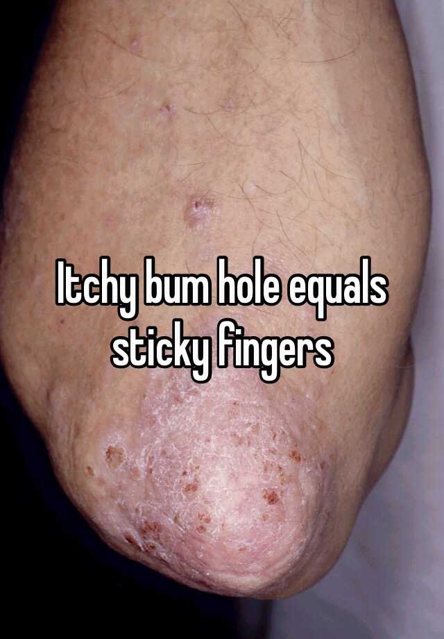 Itchy Bum Hole Equals Sticky Fingers