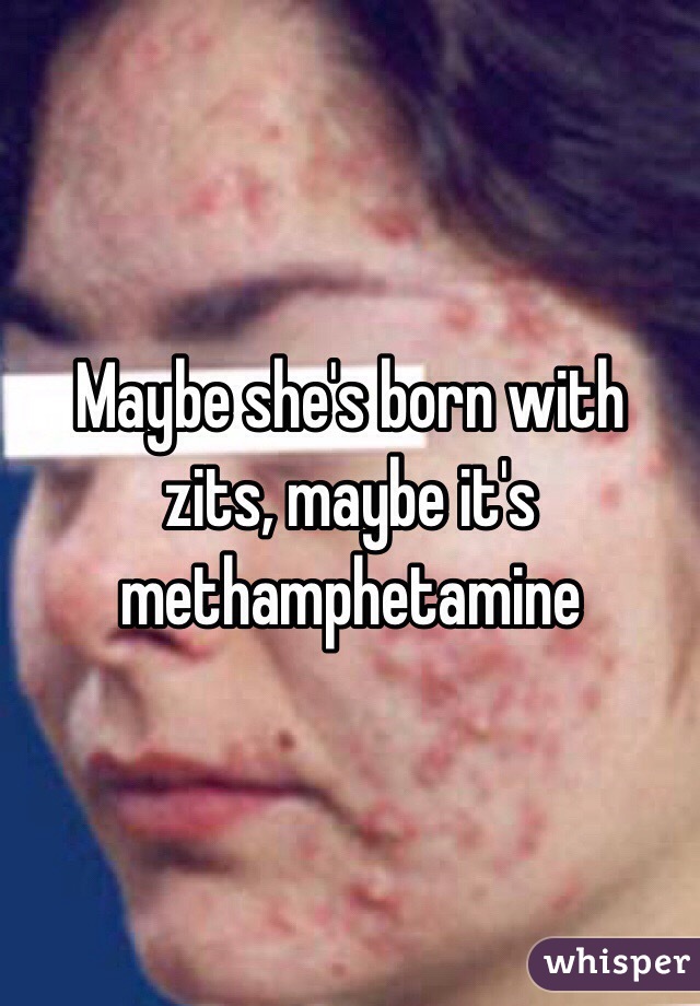 Maybe she's born with zits, maybe it's methamphetamine