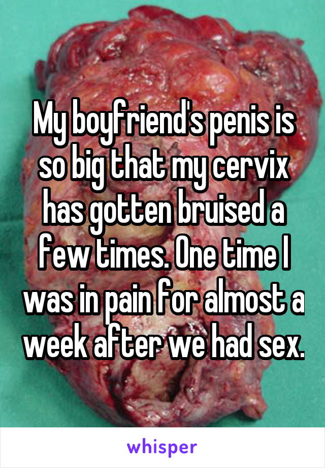 My boyfriend's penis is so big that my cervix has gotten bruised a few times. One time I was in pain for almost a week after we had sex.