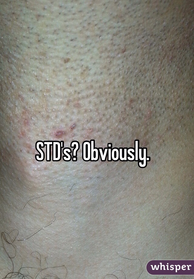 STD's? Obviously. 