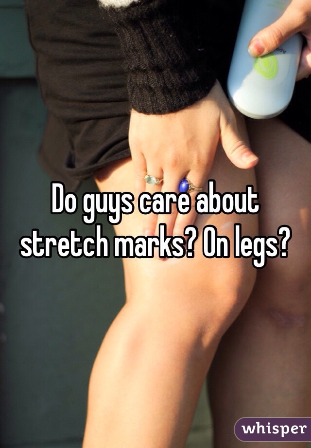 Do guys care about stretch marks? On legs? 