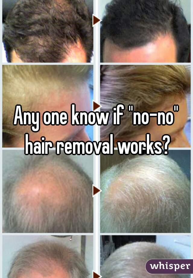 Any one know if "no-no" hair removal works?