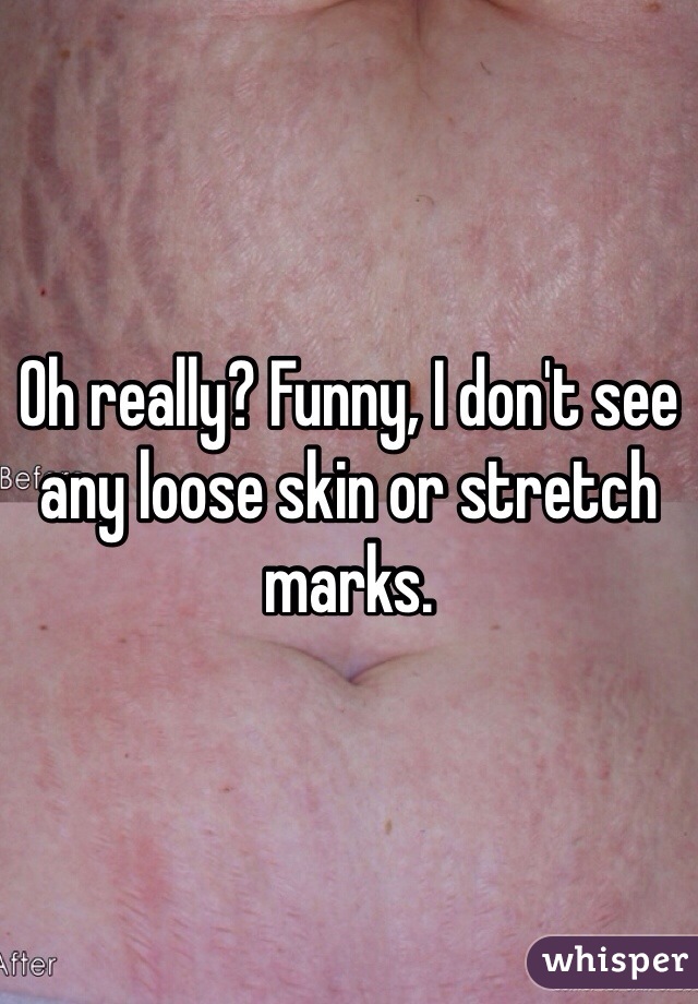 Oh really? Funny, I don't see any loose skin or stretch marks.