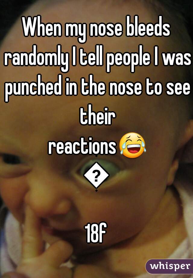 When my nose bleeds randomly I tell people I was punched in the nose to see their reactions😂😂
18f