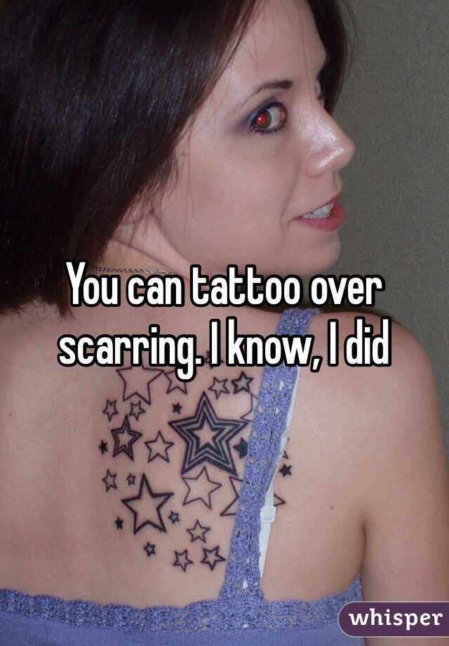 You can tattoo over scarring. I know, I did