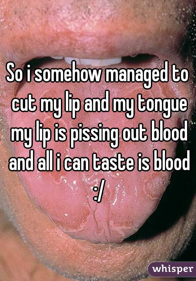 So i somehow managed to cut my lip and my tongue my lip is pissing out blood and all i can taste is blood :/