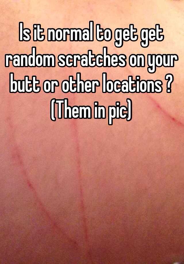 is-it-normal-to-get-get-random-scratches-on-your-butt-or-other