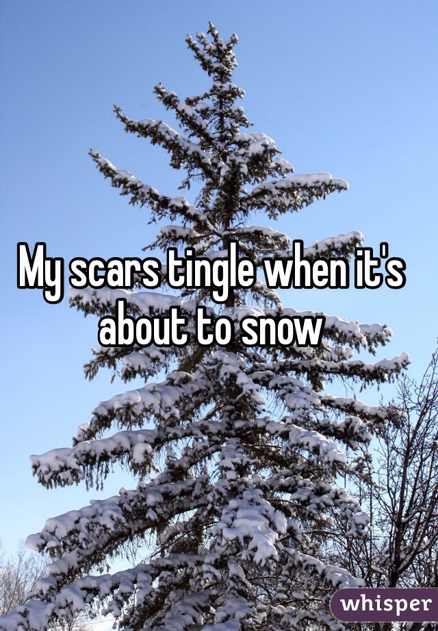 My scars tingle when it's about to snow