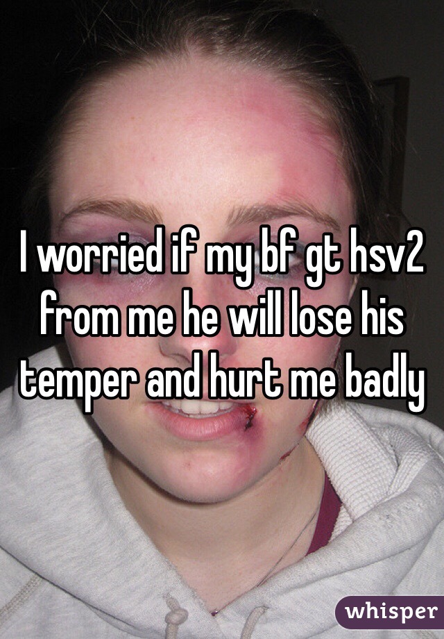 I worried if my bf gt hsv2 from me he will lose his temper and hurt me badly