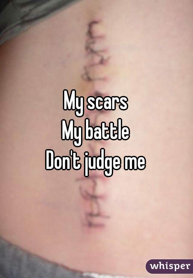My scars
My battle
Don't judge me