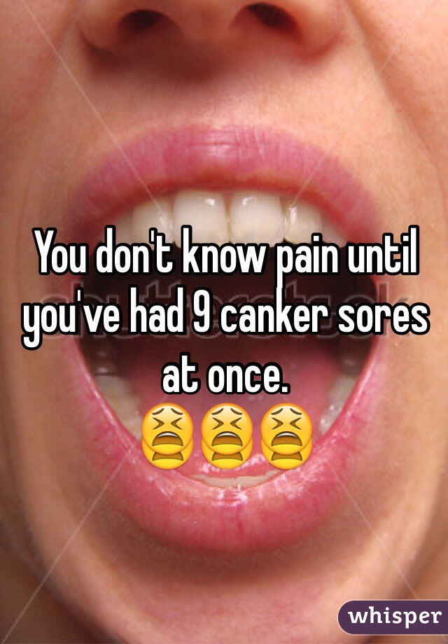 You don't know pain until you've had 9 canker sores at once.
😫😫😫