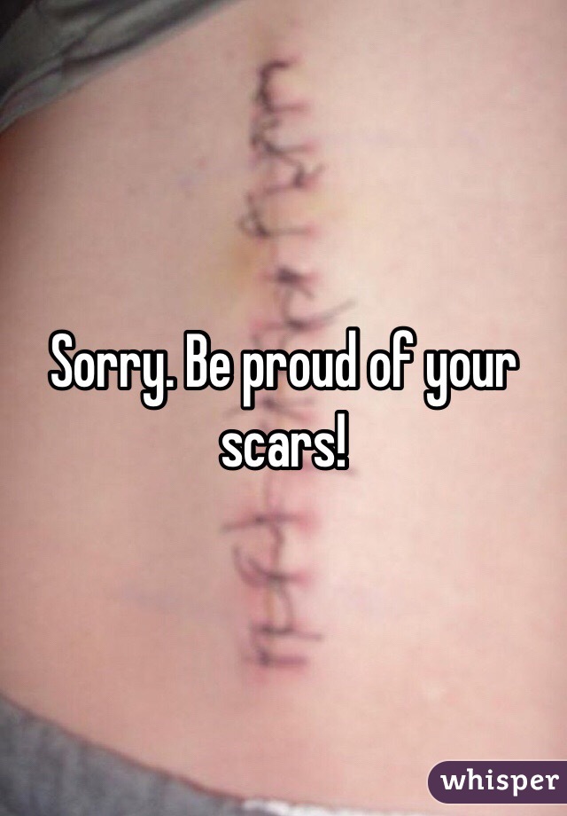 Sorry. Be proud of your scars!
