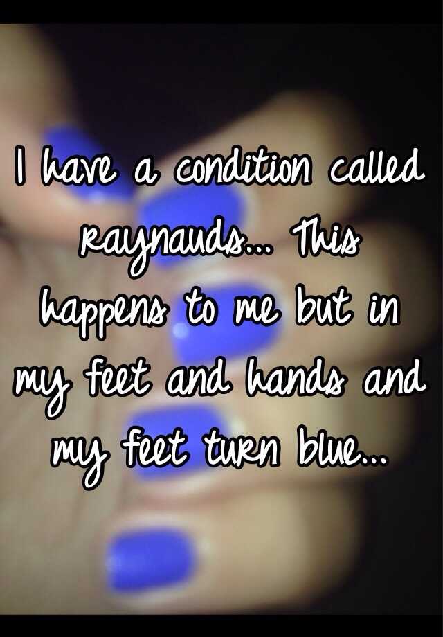 i-have-a-condition-called-raynauds-this-happens-to-me-but-in-my-feet