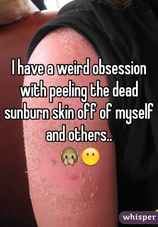 I have a weird obsession with peeling the dead sunburn skin off of myself and others..
🙊😶