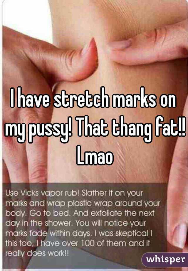 I have stretch marks on my pussy! That thang fat!! Lmao