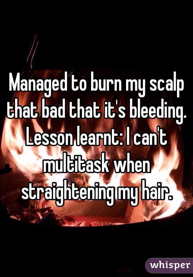 Managed to burn my scalp that bad that it's bleeding. 
Lesson learnt: I can't multitask when straightening my hair. 