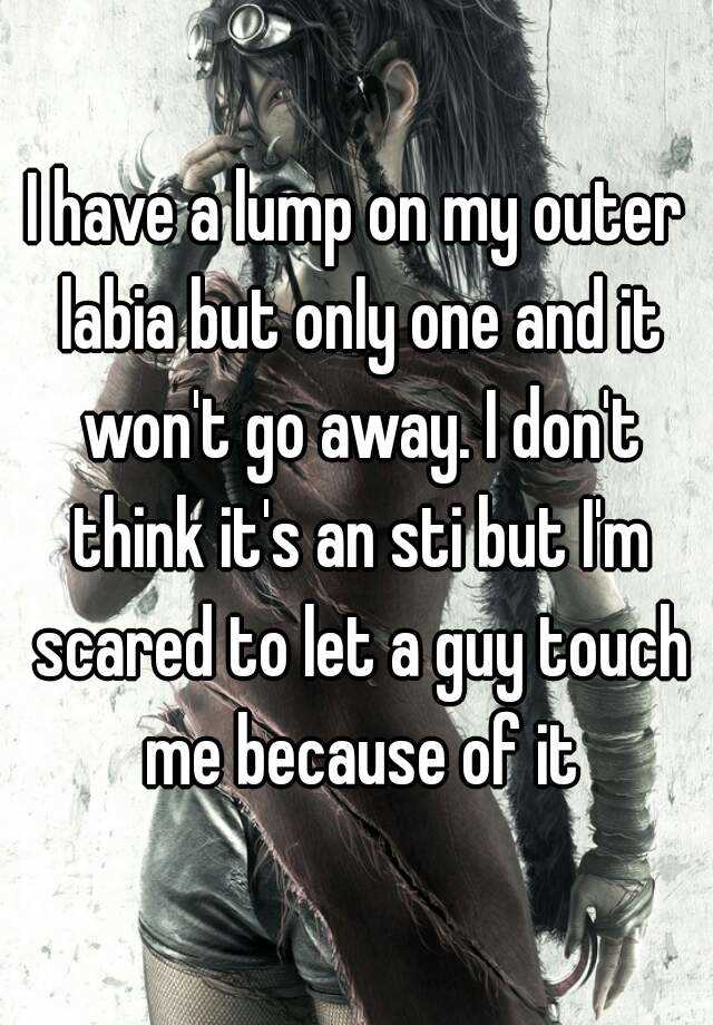 i-have-a-lump-on-my-outer-labia-but-only-one-and-it-won-t-go-away-i