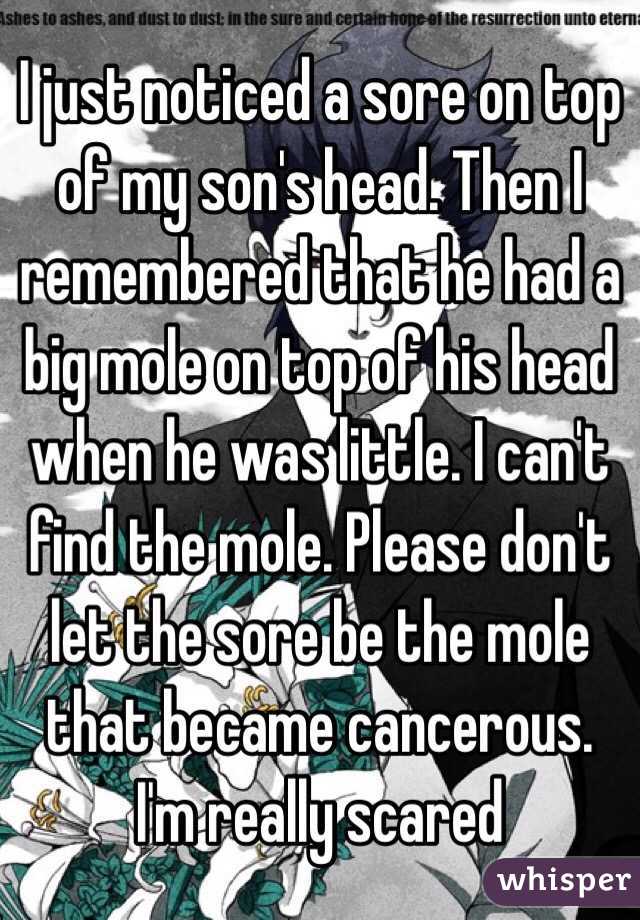 I just noticed a sore on top of my son's head. Then I remembered that he had a big mole on top of his head when he was little. I can't find the mole. Please don't let the sore be the mole that became cancerous. I'm really scared