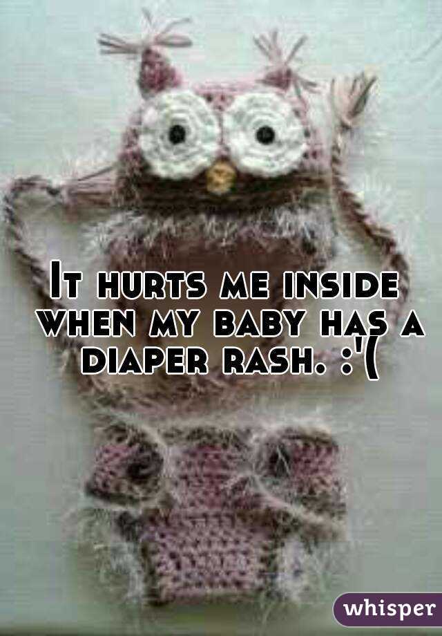 It hurts me inside when my baby has a diaper rash. :'(