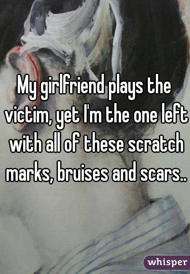 My girlfriend plays the victim, yet I'm the one left with all of these scratch marks, bruises and scars..