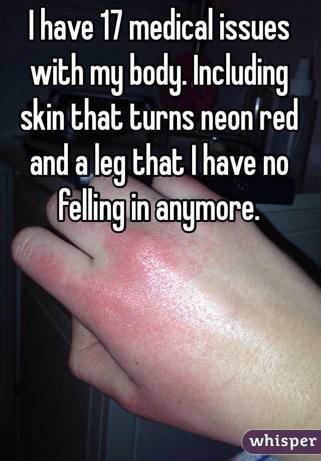 I have 17 medical issues with my body. Including skin that turns neon red and a leg that I have no felling in anymore.