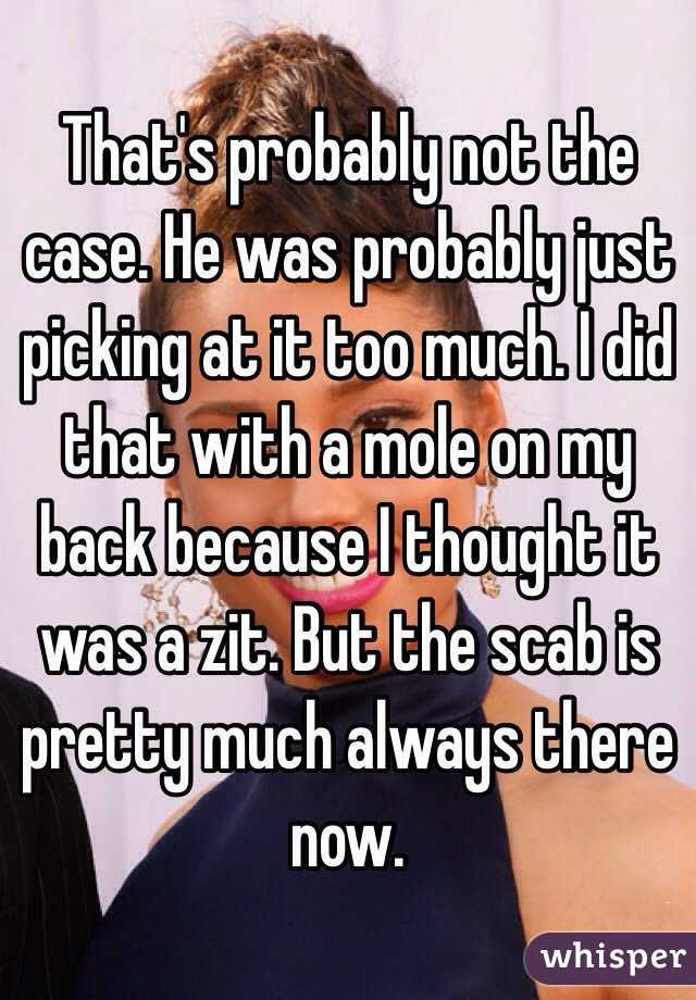 That's probably not the case. He was probably just picking at it too much. I did that with a mole on my back because I thought it was a zit. But the scab is pretty much always there now.